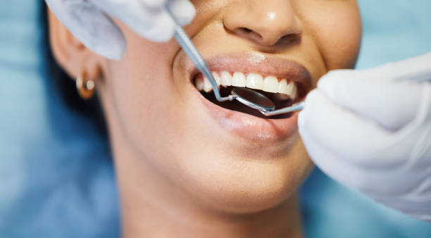 Best Urgent Care for Lost Fillings or Crowns in Bluff City, TN