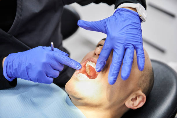 Best Emergency Tooth Extraction in Bluff City, TN